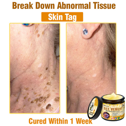 🍟Ourlyard® Bee venom Pro Comprehensive Cream — 🔥Limited Time 80% OFF🔥