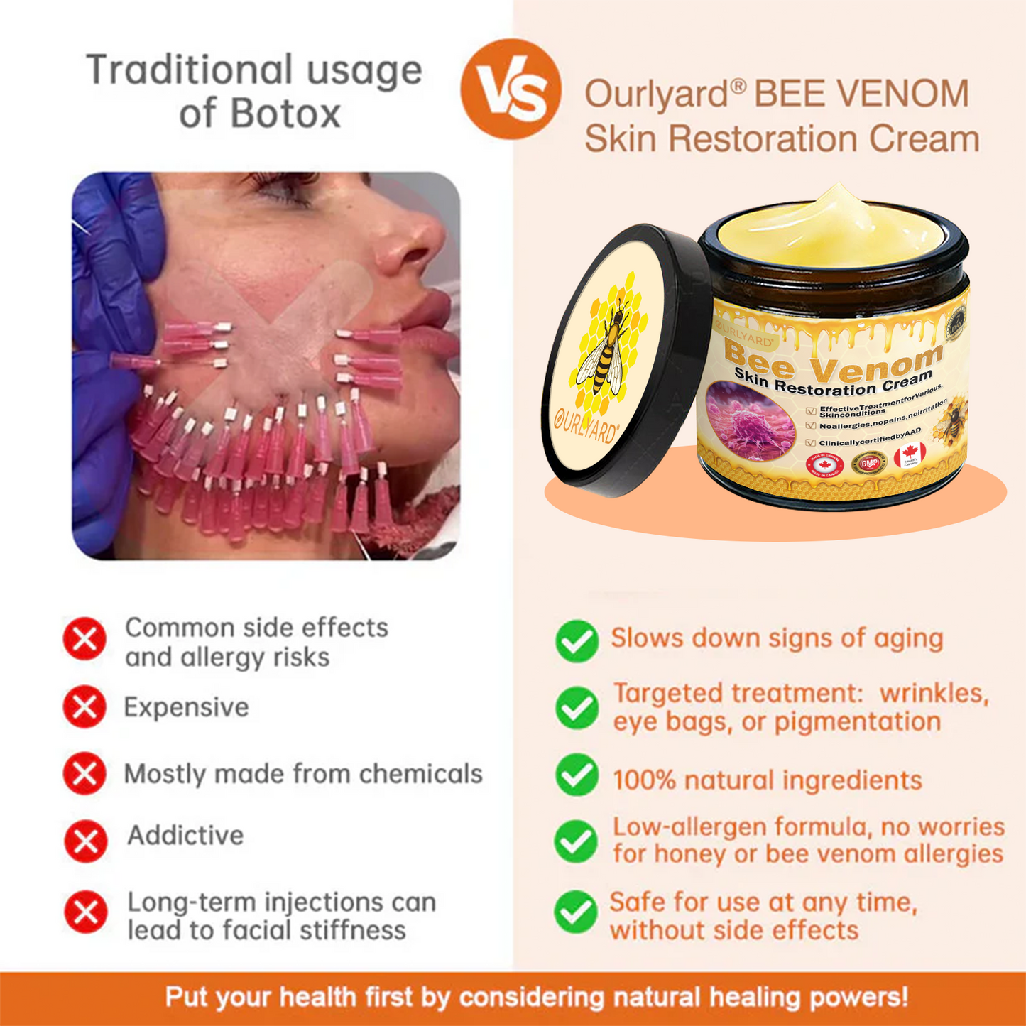 🍟Ourlyard® Bee venom Pro Comprehensive Cream — 🔥Limited Time 80% OFF🔥