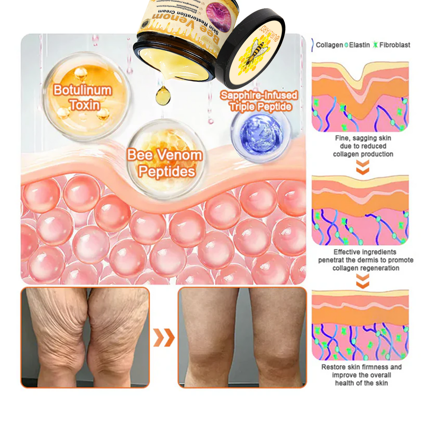 🍟Ourlyard® Bee venom Pro Comprehensive Cream — 🔥Limited Time 80% OFF🔥