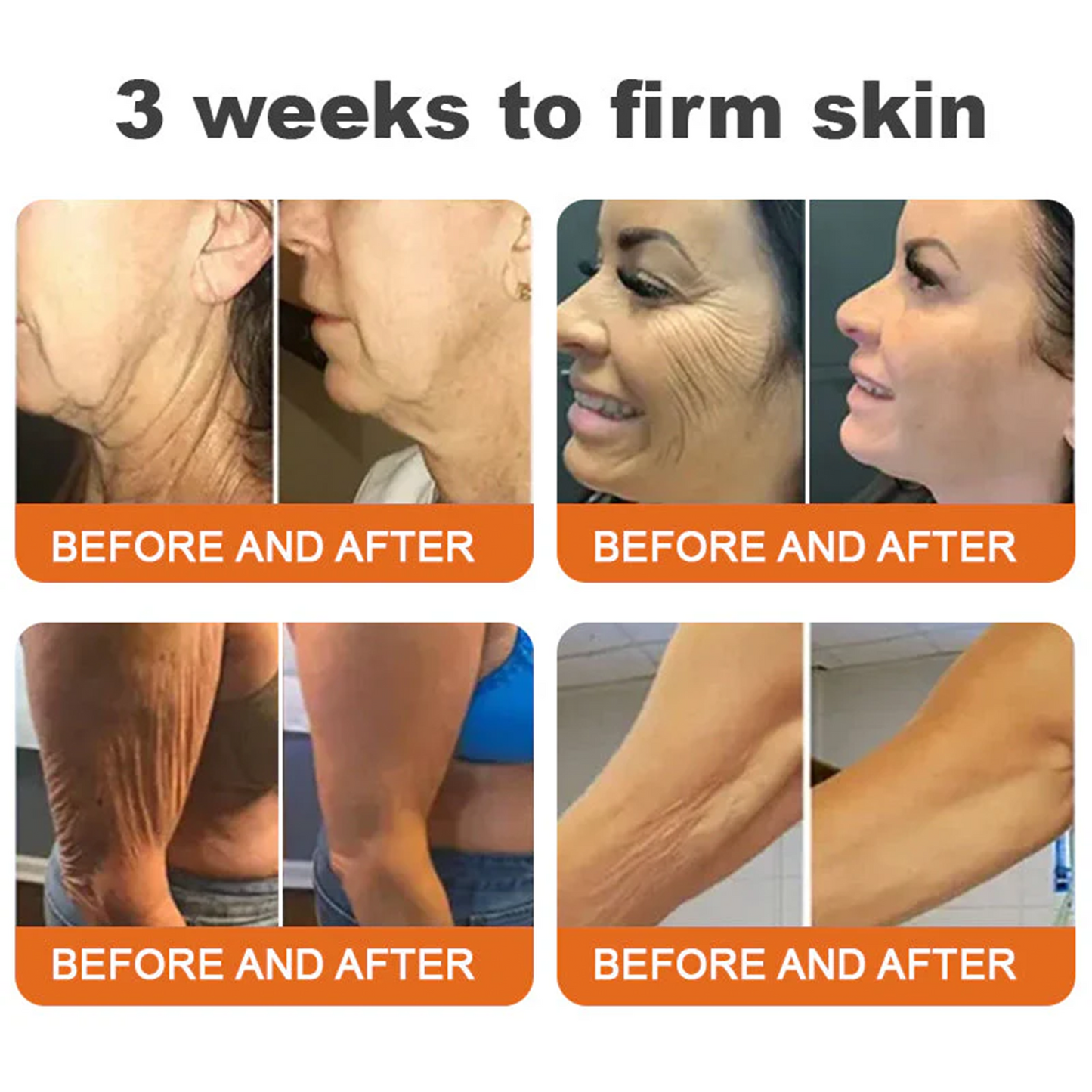 🍟Ourlyard® Bee venom Pro Comprehensive Cream — 🔥Limited Time 80% OFF🔥