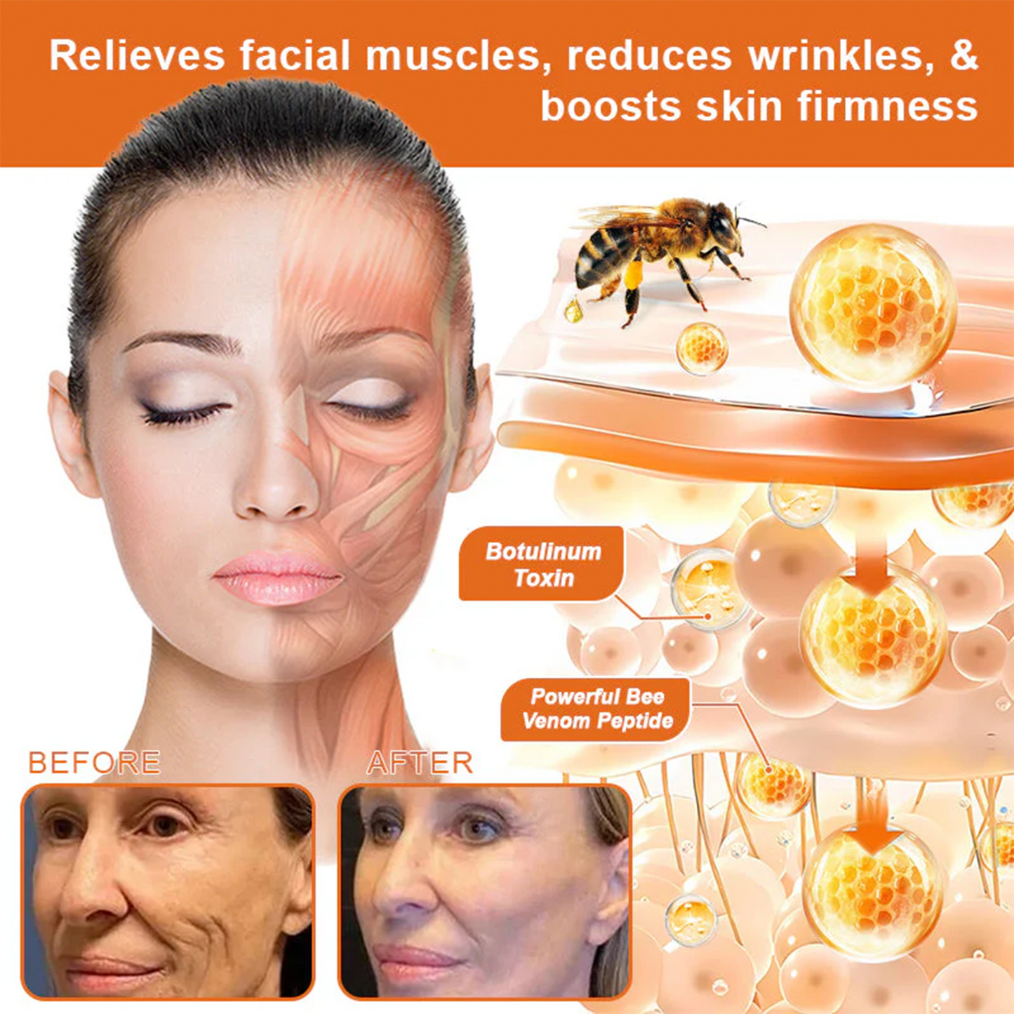 🍟Ourlyard® Bee venom Pro Comprehensive Cream — 🔥Limited Time 80% OFF🔥
